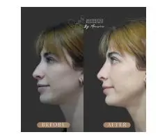 Explore a Consultation-Led Approach to Nasal Profiling