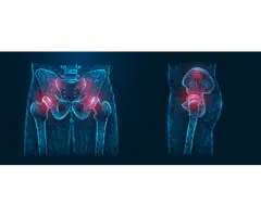 Total Hip Replacement Surgery Wodonga